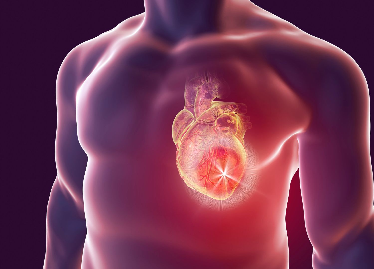 Heart Attack: Causes, Symptoms, and Treatment