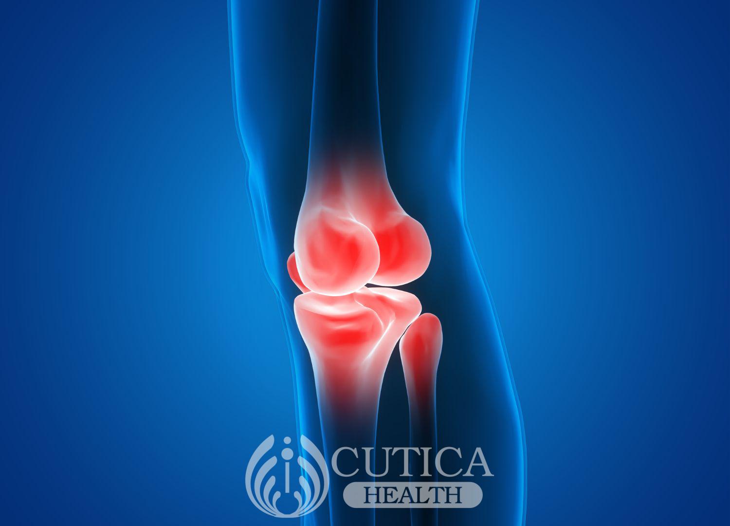 "Osteomyelitis (Bone infection).  What you should know (Pidgin)"