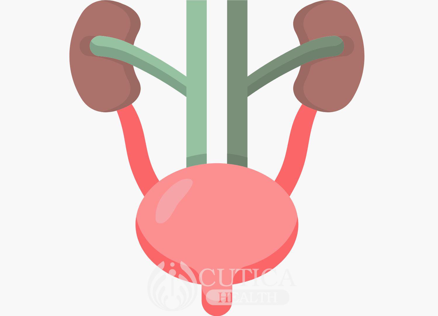 Urinary tract Obstruction (Pidgin)