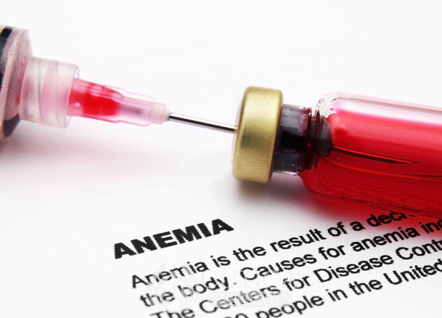 Anemia: Causes and Treatment