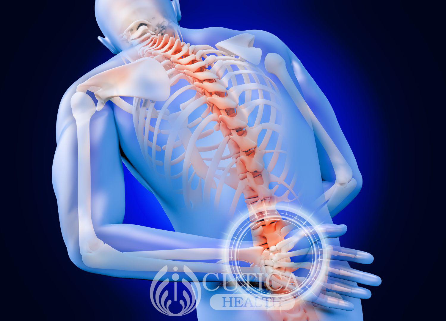 Chronic pain syndromes