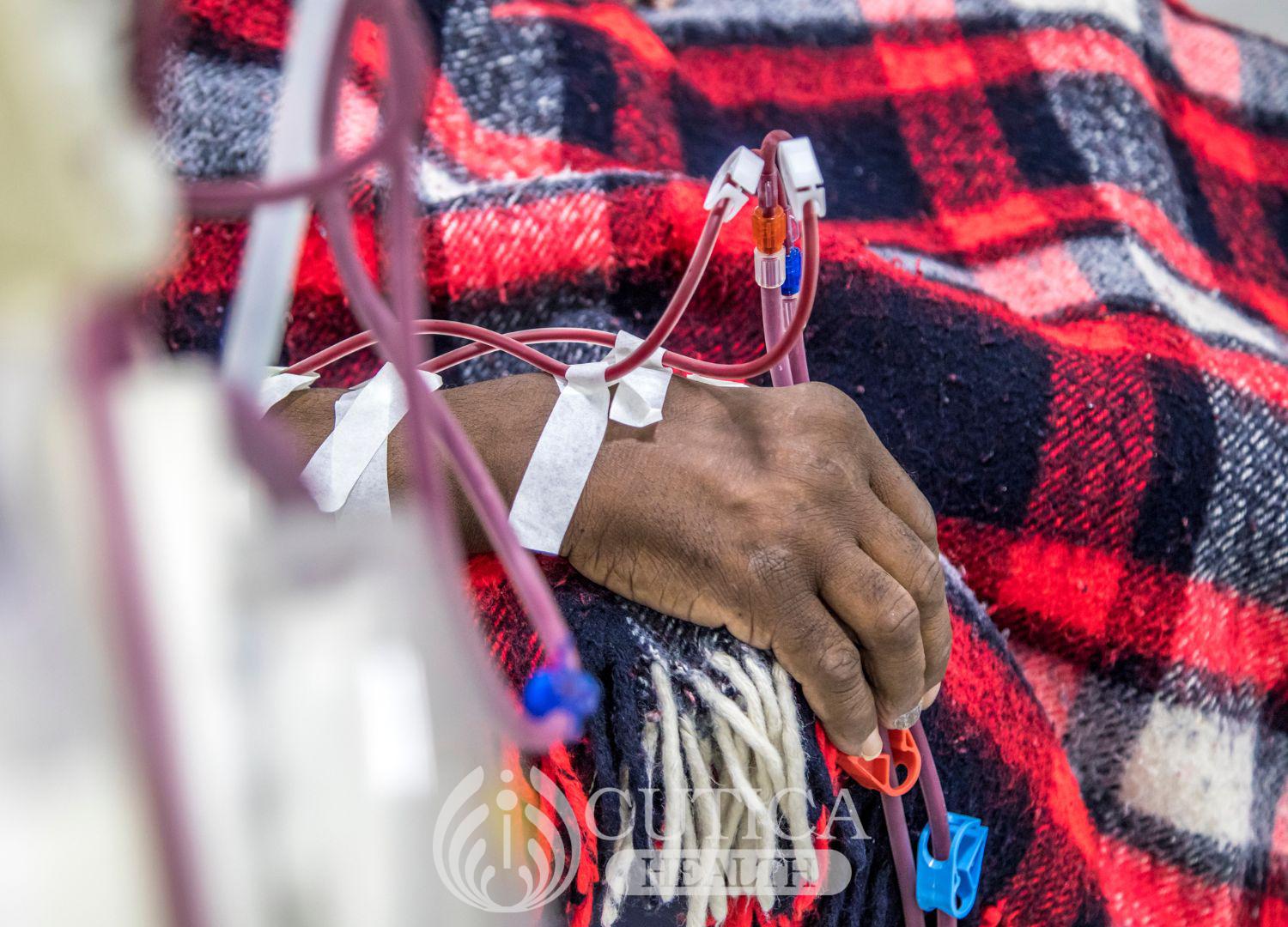Dialysis: What you need to know