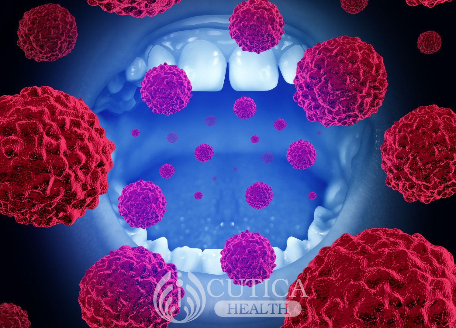 "Oral Cancer: Be careful of these risk  factors"