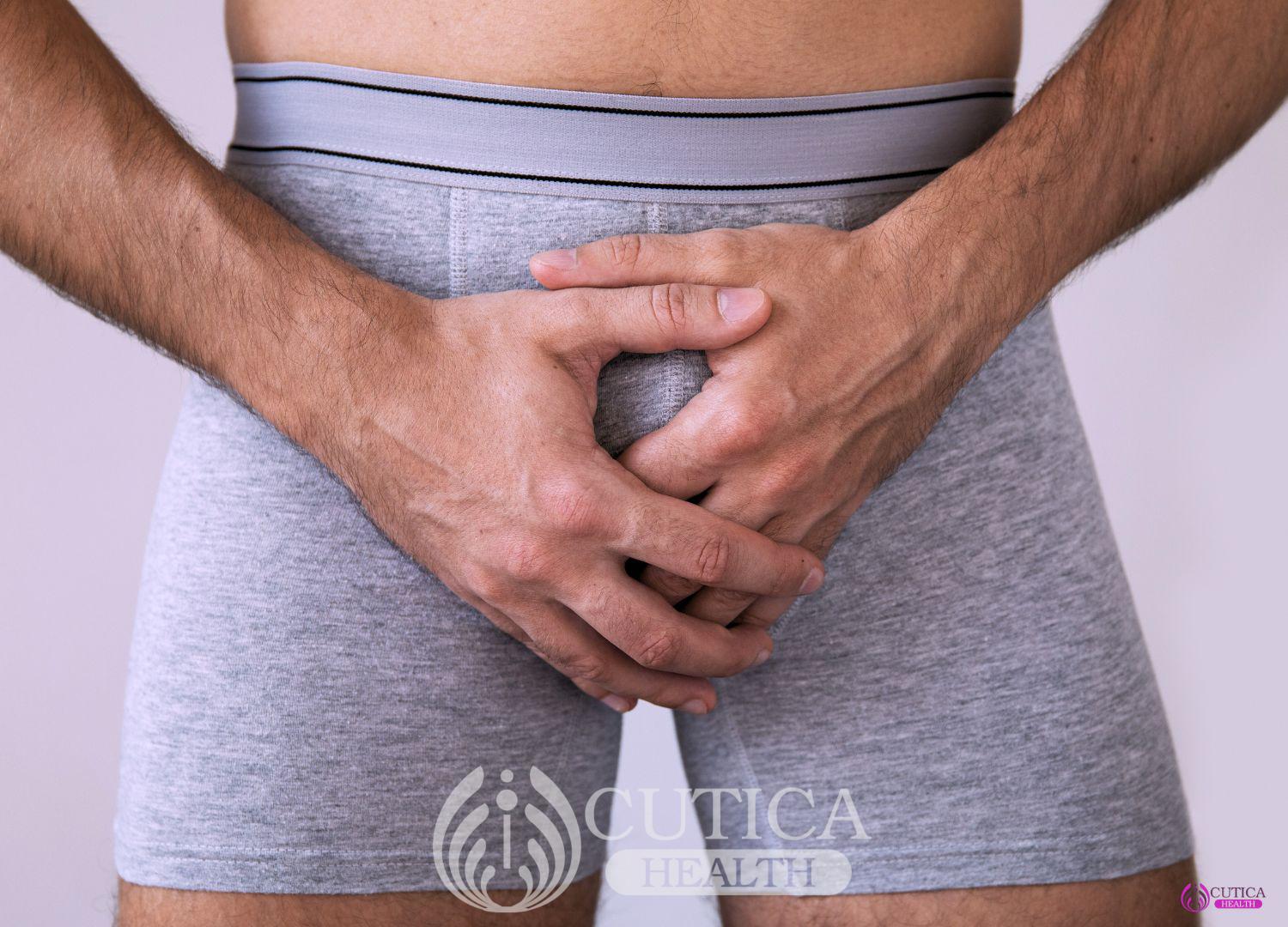 Understanding Penile Discharge: Causes, Symptoms, and Treatments (Pidgin)