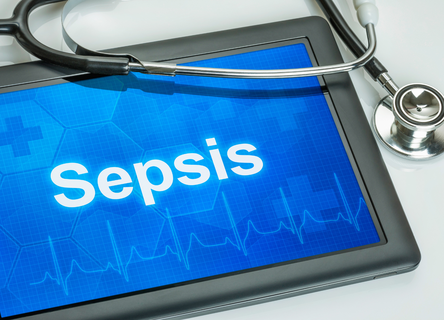 Reducing Sepsis Fatalities in Critically Ill Patients